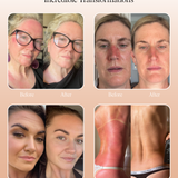 Mud Organics Sea Buckthorn Serum customer transformation results