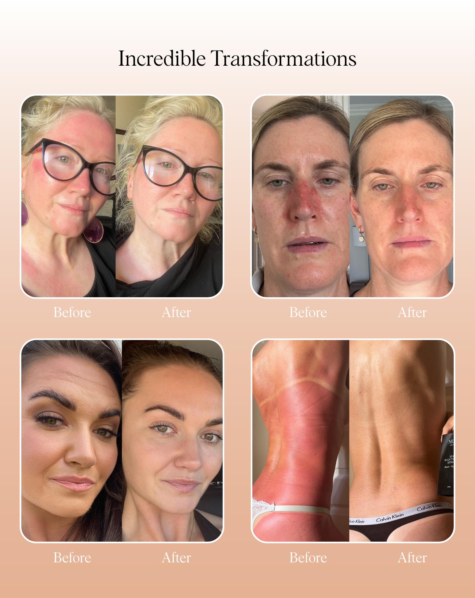 Mud Organics Sea Buckthorn Serum customer transformation results