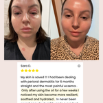 Mud Organics Sea Buckthorn Serum customer pigmentation before and after