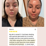 Mud Organics Sea Buckthorn Serum customer pigmentation before and after