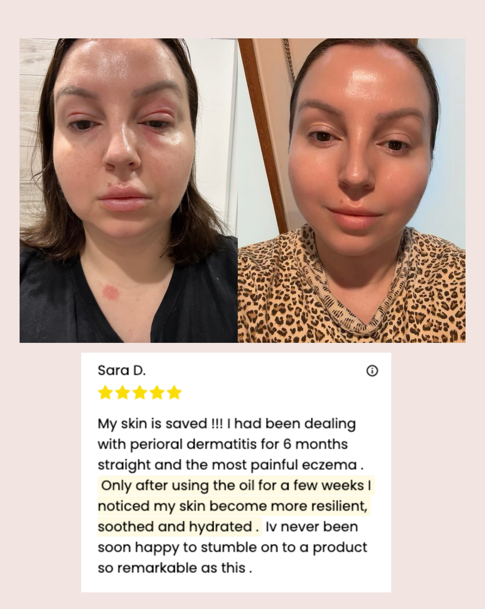 Mud Organics Sea Buckthorn Serum customer pigmentation before and after