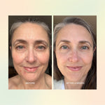 Before and after skin comparison using The Jojoba Company Jojoba Boost Skin Renewal