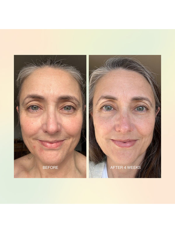 Before and after skin comparison using The Jojoba Company Jojoba Boost Skin Renewal