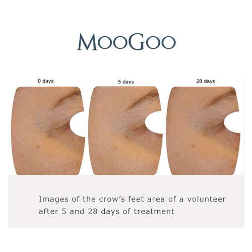 MooGoo Amplified Anti-Ageing Peptide Active Serum with Argireline® 25ml — official MooGoo clinical before-and-after image 9