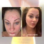 Before and after skin comparison over four weeks using The Jojoba Company Australian Jojoba