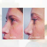 Second before and after comparison using The Jojoba Company Transformative Eye Serum