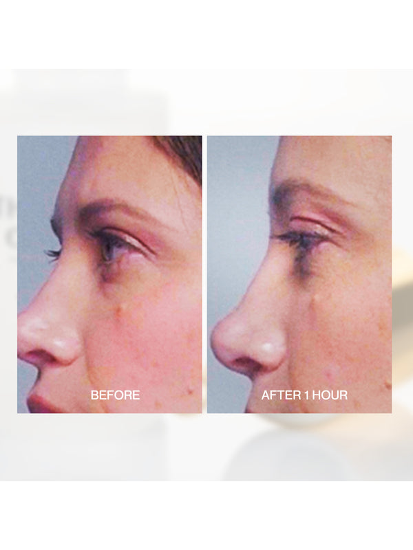 Second before and after comparison using The Jojoba Company Transformative Eye Serum