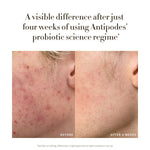 Before and after results from four weeks of Antipodes Credo Probiotic Anti-Blemish Serum