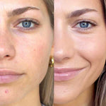 Close-up of a woman’s face split in half: the left side (before) shows pores and blemishes, while the right (after using Ere Perez Arnica All-Cover Pot 5g) reveals clearer, smoother skin and a slight smile.