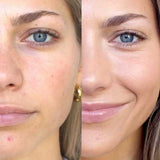 Close-up of a woman’s face split in half: the left side (before) shows pores and blemishes, while the right (after using Ere Perez Arnica All-Cover Pot 5g) reveals clearer, smoother skin and a slight smile.
