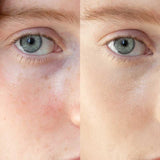 Ere Perez Lychee Crème Corrector 10ml