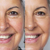 Close-up of a smiling woman’s face: the left side shows redness and uneven tone, while the right displays smoother, even skin with medium coverage from Ere Perez Oat Milk Foundation 30ml.