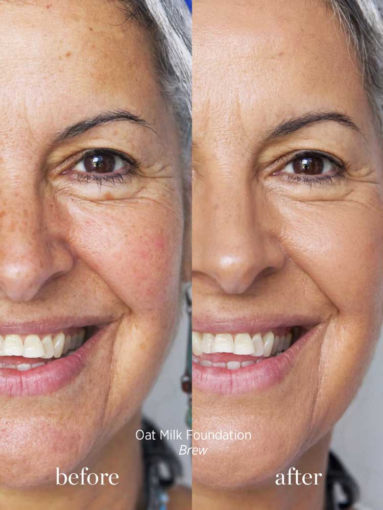 Close-up of a smiling woman’s face: the left side shows redness and uneven tone, while the right displays smoother, even skin with medium coverage from Ere Perez Oat Milk Foundation 30ml.