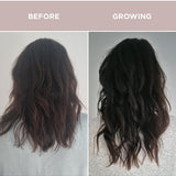 Before and after hair growth comparison using Tropeaka Hair Complex