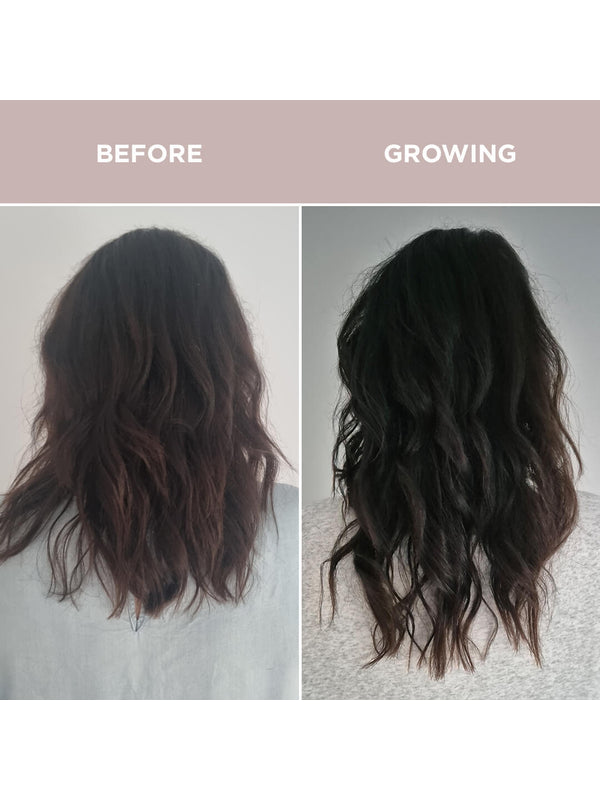 Before and after hair growth comparison using Tropeaka Hair Complex