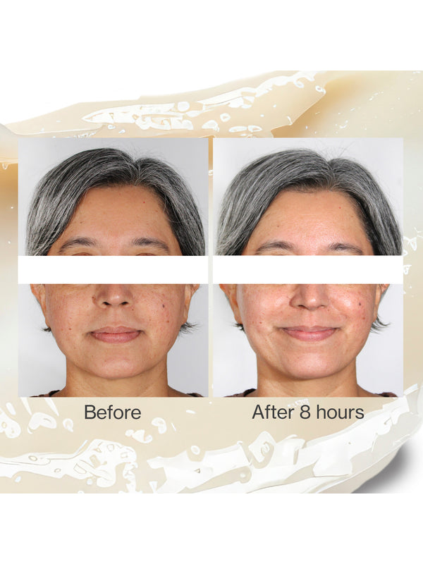 Before and after skin comparison using The Jojoba Company Jojoba Intense Moisture Balm
