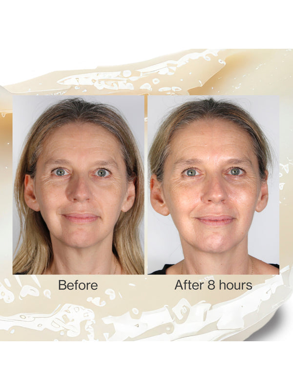 Second before and after skin comparison using The Jojoba Company Jojoba Intense Moisture Balm