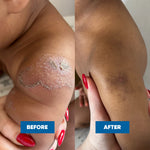 MooGoo Mini Moo Baby Eczema & Psoriasis Cream 120g — official MooGoo clinical before-and-after image 6