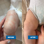 MooGoo Pink Eczema Cream 120g clinical results