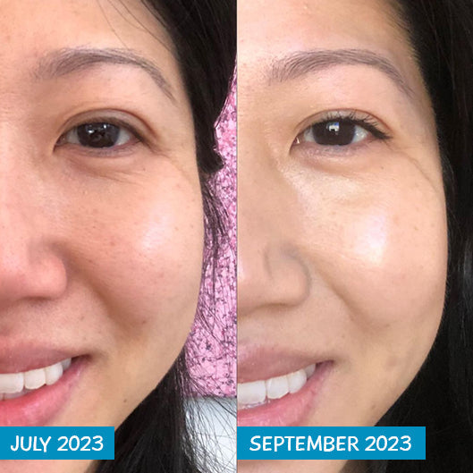 MooGoo Amplified Anti-Ageing Peptide Active Serum with Argireline® 25ml — official MooGoo product information image 2