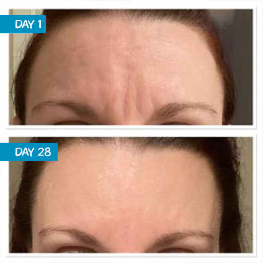 MooGoo Amplified Anti-Ageing Peptide Active Serum with Argireline® 25ml — official MooGoo product information image 4
