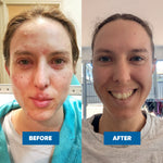 MooGoo Milk Wash 500ml — official MooGoo clinical before-and-after image 2
