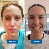 MooGoo Milk Wash 500ml — official MooGoo clinical before-and-after image 2