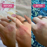 MooGoo Pink Eczema Cream 120g clinical results