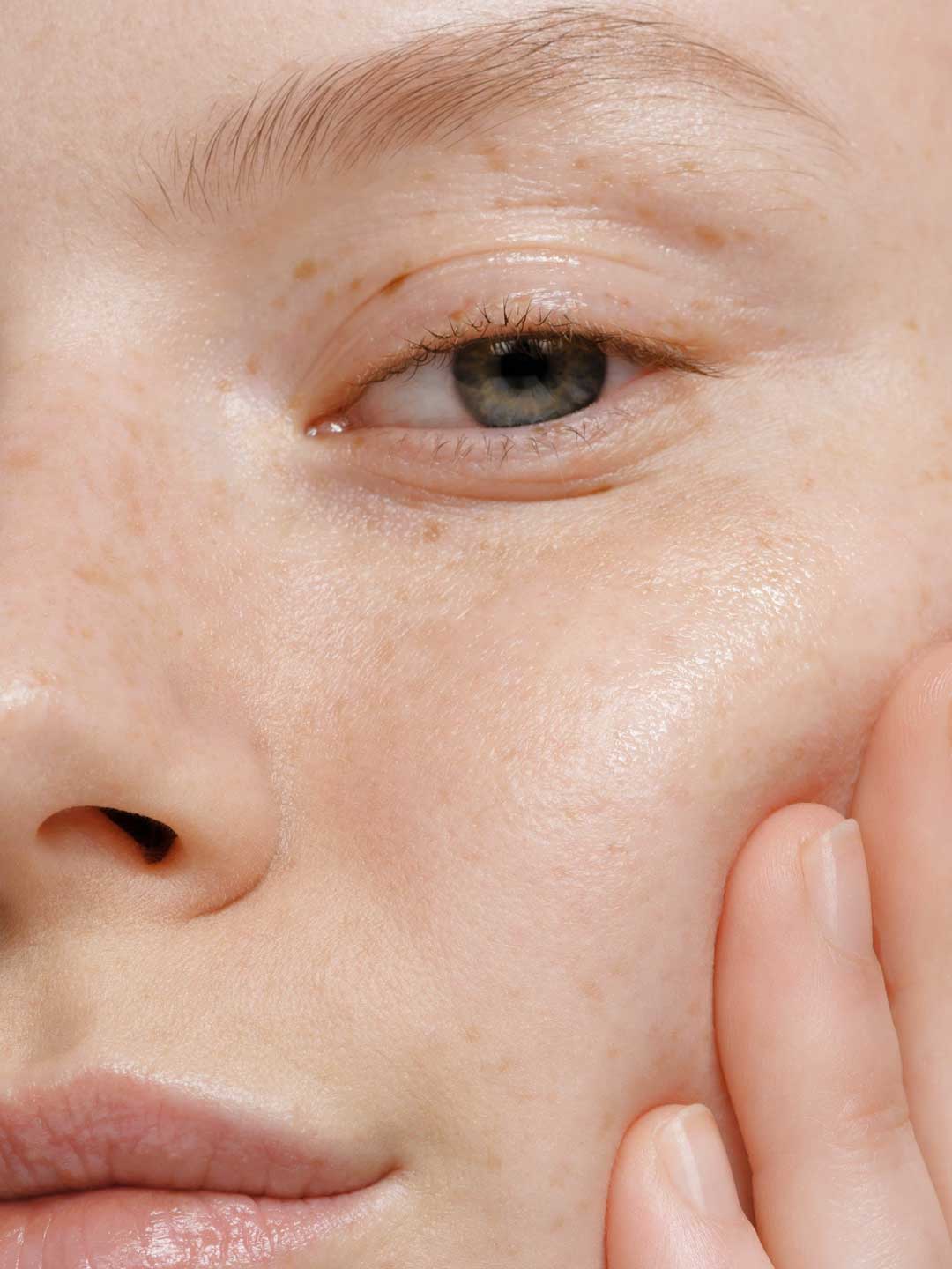 A close-up of a person’s radiant skin, highlighted by a gently touching hand, showcases the natural glow and clarity achieved with Madara Niacinamide Alternative 5-in-1 Serum 30ml by Madara—perfect for breakout-prone skin.