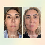 Before and after skin comparison over four weeks using The Jojoba Company Jojoba Boost Skin Barrier Support