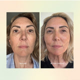 Before and after skin comparison over four weeks using The Jojoba Company Jojoba Boost Skin Barrier Support