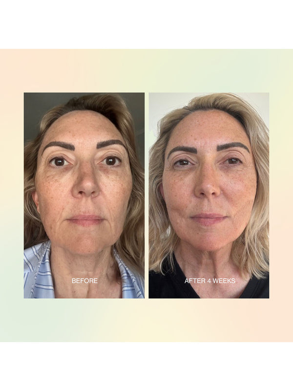 Before and after skin comparison over four weeks using The Jojoba Company Jojoba Boost Skin Barrier Support