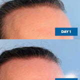 MooGoo Hair Growth Serum 30ml