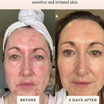 Mud Organics Sea Buckthorn Serum customer before and after results