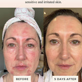 Mud Organics Sea Buckthorn Serum customer before and after results