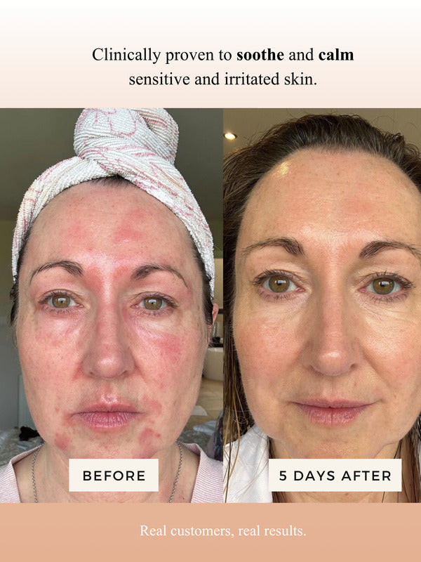 Mud Organics Sea Buckthorn Serum customer before and after results
