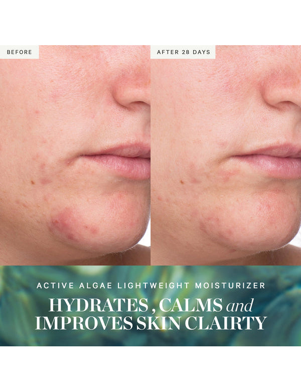 Before and after results from KORA Organics Active Algae Lightweight Moisturiser