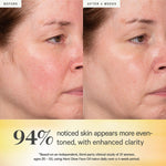 Before and after results from KORA Organics Noni Glow Face Oil