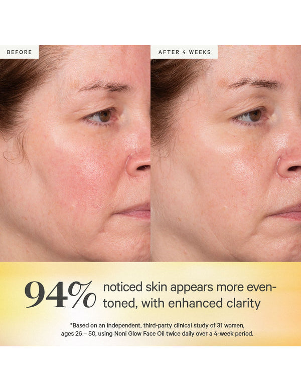Before and after results from KORA Organics Noni Glow Face Oil