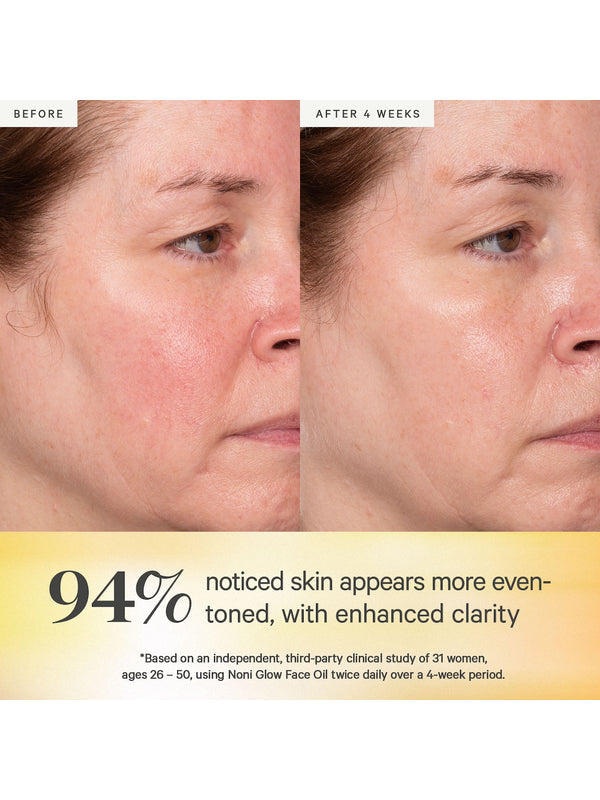 Before and after results from KORA Organics Noni Glow Face Oil