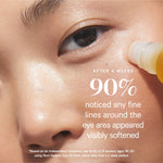 Close-up of a rollerball applying Noni Radiant Eye Oil below an eye. KORA reports that 90% noticed visibly softened fine lines around the eyes after four weeks, based on an independent study of 31 women aged 36–50 using it twice daily.