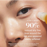 Close-up of a rollerball applying Noni Radiant Eye Oil below an eye. KORA reports that 90% noticed visibly softened fine lines around the eyes after four weeks, based on an independent study of 31 women aged 36–50 using it twice daily.
