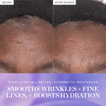 Before and After 28 Days close-ups of a forehead beneath a black headband, with lines appearing softer in the second photo. KORA's Plant Stem Cell Retinol Alternative Moisturiser caption says it smooths wrinkles and fine lines and boosts hydration.