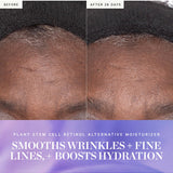 Before and After 28 Days close-ups of a forehead beneath a black headband, with lines appearing softer in the second photo. KORA's Plant Stem Cell Retinol Alternative Moisturiser caption says it smooths wrinkles and fine lines and boosts hydration.