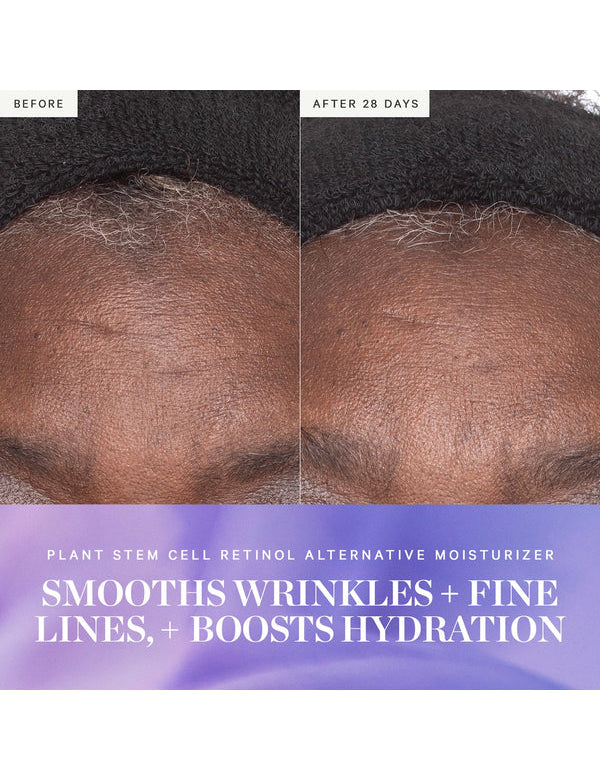 Before and after results from KORA Organics Plant Stem Cell Retinol Alternative Moisturiser