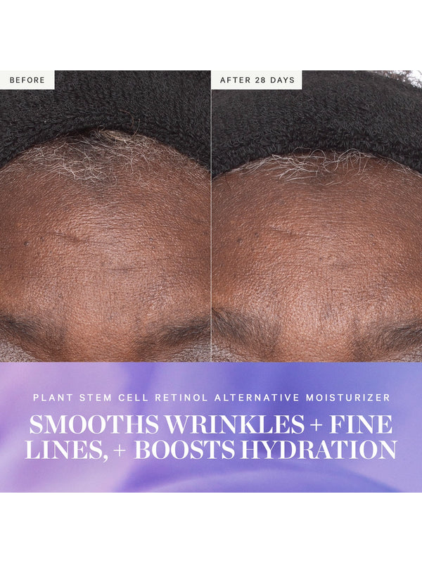 Before and After 28 Days close-ups of a forehead beneath a black headband, with lines appearing softer in the second photo. KORA's Plant Stem Cell Retinol Alternative Moisturiser caption says it smooths wrinkles and fine lines and boosts hydration.