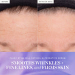 Before and after results from KORA Organics Plant Stem Cell Retinol Alternative Serum