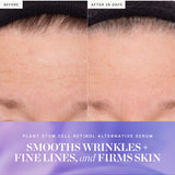 Before and after results from KORA Organics Plant Stem Cell Retinol Alternative Serum