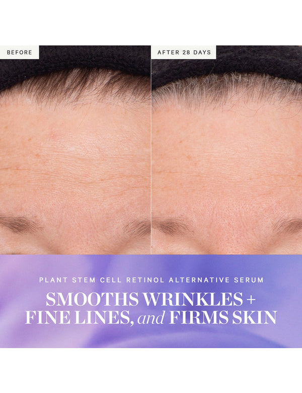 Before and after results from KORA Organics Plant Stem Cell Retinol Alternative Serum