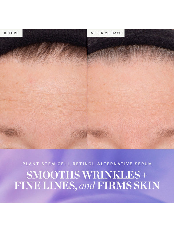 Before and after results from KORA Organics Plant Stem Cell Retinol Alternative Serum